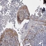 LAD1 Antibody in Immunohistochemistry (IHC)