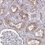 LAD1 Antibody in Immunohistochemistry (IHC)