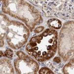 MECR Antibody in Immunohistochemistry (IHC)