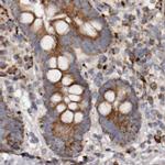 MECR Antibody in Immunohistochemistry (IHC)