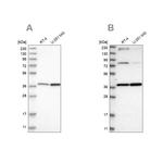 MECR Antibody in Western Blot (WB)