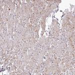 GARNL3 Antibody in Immunohistochemistry (IHC)