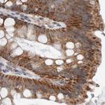 MRPL18 Antibody in Immunohistochemistry (IHC)