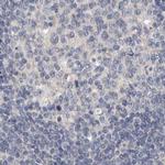 MRPL18 Antibody in Immunohistochemistry (IHC)