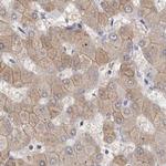 MRPL18 Antibody in Immunohistochemistry (IHC)