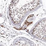 SLC10A4 Antibody in Immunohistochemistry (IHC)