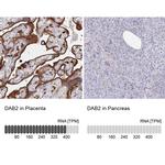 DAB2 Antibody in Immunohistochemistry (IHC)