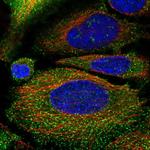 DAB2 Antibody in Immunocytochemistry (ICC/IF)