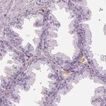 RNF36 Antibody in Immunohistochemistry (IHC)