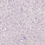 APLP1 Antibody in Immunohistochemistry (IHC)