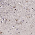 EGR4 Antibody in Immunohistochemistry (IHC)