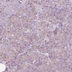 EGR4 Antibody in Immunohistochemistry (IHC)