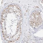 ETHE1 Antibody in Immunohistochemistry (IHC)