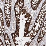 ETHE1 Antibody in Immunohistochemistry (IHC)