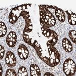 ETHE1 Antibody in Immunohistochemistry (IHC)