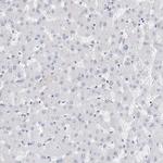 LRRC16A Antibody in Immunohistochemistry (IHC)