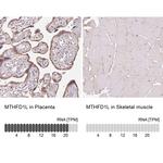 MTHFD1L Antibody in Immunohistochemistry (IHC)