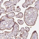 MTHFD1L Antibody in Immunohistochemistry (IHC)