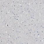 RGN Antibody in Immunohistochemistry (IHC)