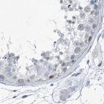 RGN Antibody in Immunohistochemistry (IHC)