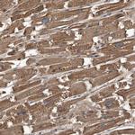 Kir2.1 (KCNJ2) Antibody in Immunohistochemistry (IHC)