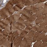 Kir2.1 (KCNJ2) Antibody in Immunohistochemistry (IHC)