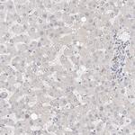 RABAC1 Antibody in Immunohistochemistry (IHC)