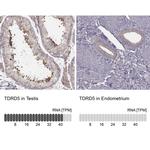 TDRD5 Antibody