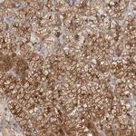 TCP-1 theta Antibody in Immunohistochemistry (IHC)