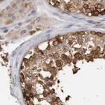 TCP-1 theta Antibody in Immunohistochemistry (IHC)