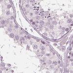 PAEP Antibody in Immunohistochemistry (IHC)