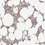 Transketolase Antibody in Immunohistochemistry (IHC)