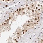 Transketolase Antibody in Immunohistochemistry (IHC)