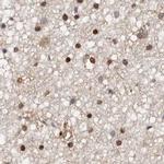 Transketolase Antibody in Immunohistochemistry (IHC)