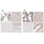 Transketolase Antibody in Immunohistochemistry (IHC)