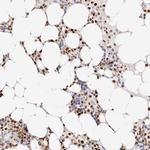 Transketolase Antibody in Immunohistochemistry (IHC)