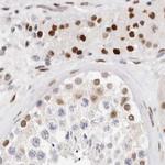 Transketolase Antibody in Immunohistochemistry (IHC)