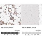 Transketolase Antibody