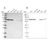 Transketolase Antibody in Western Blot (WB)