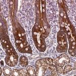 BAIAP2L1 Antibody in Immunohistochemistry (IHC)