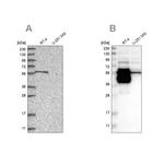 BAIAP2L1 Antibody in Western Blot (WB)