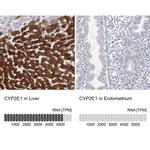CYP2E1 Antibody in Immunohistochemistry (IHC)