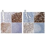 CYP2E1 Antibody in Immunohistochemistry (IHC)