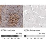 LAP3 Antibody in Immunohistochemistry (IHC)