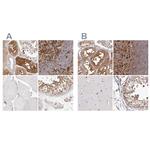 LAP3 Antibody in Immunohistochemistry (IHC)