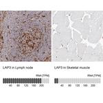 LAP3 Antibody in Immunohistochemistry (IHC)