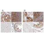 LAP3 Antibody in Immunohistochemistry (IHC)