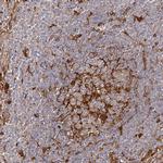 LAP3 Antibody in Immunohistochemistry (IHC)