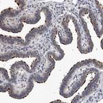 EFCAB7 Antibody in Immunohistochemistry (IHC)