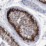 EFCAB7 Antibody in Immunohistochemistry (IHC)